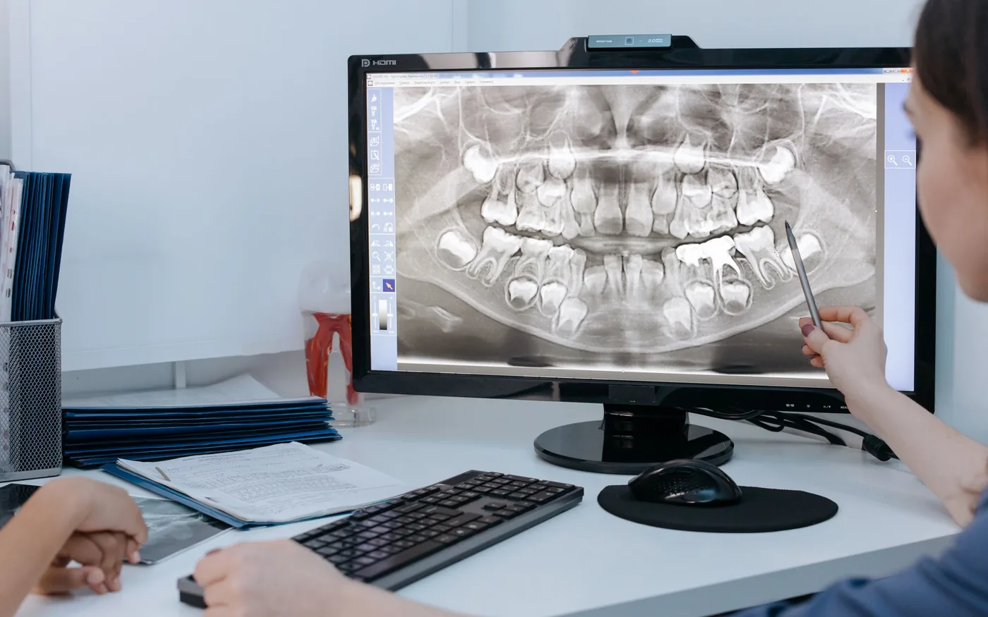 Dentist pointing at a dental radiograph on a monitor