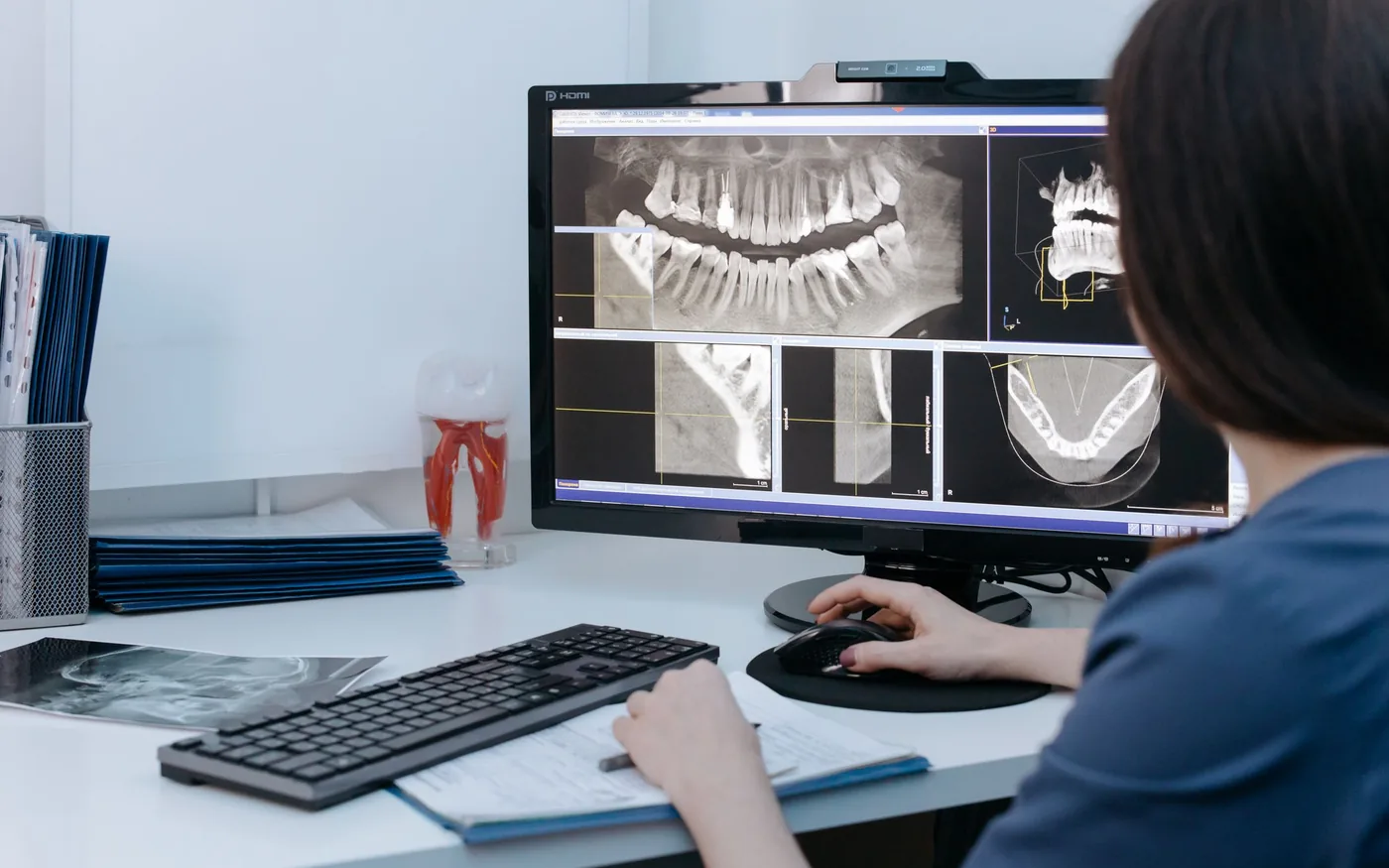 Dental professional reviewing X-rays on a computer